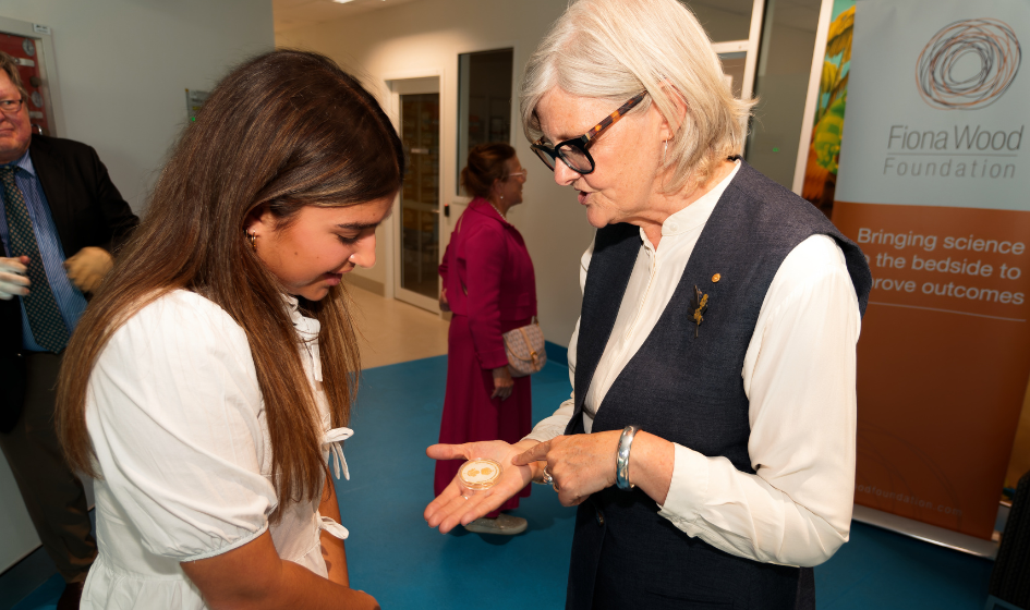 Image for Examples of deep partial thickness burns.