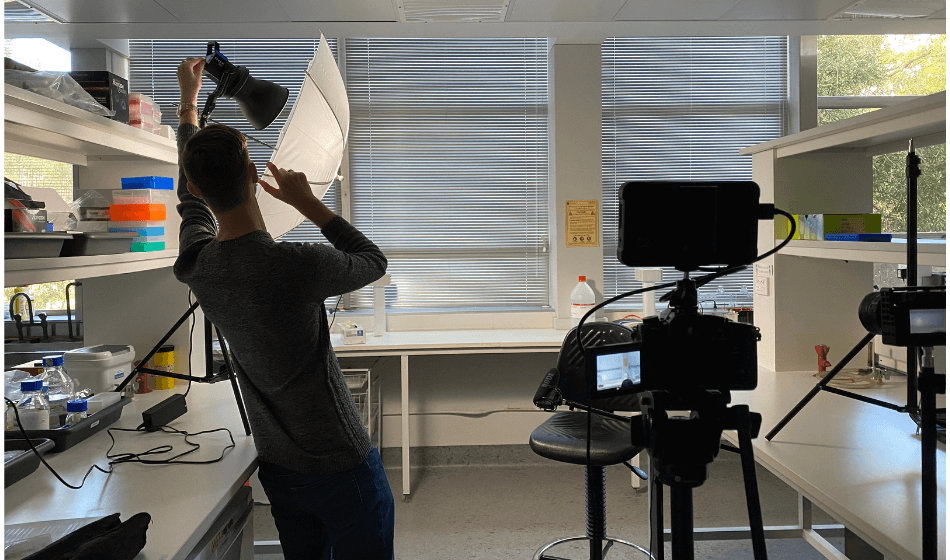 Image for Examples of deep partial thickness burns.