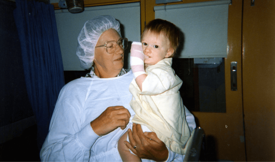 Image for Examples of deep partial thickness burns.