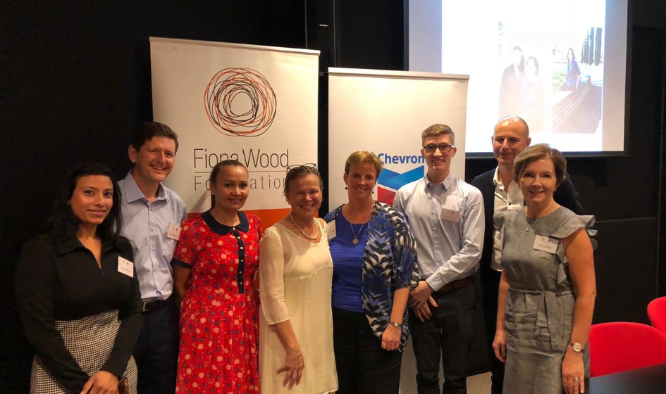 Image for Examples of deep partial thickness burns.