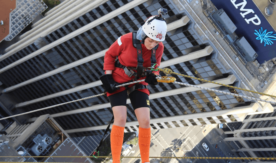 Image for Examples of deep partial thickness burns.