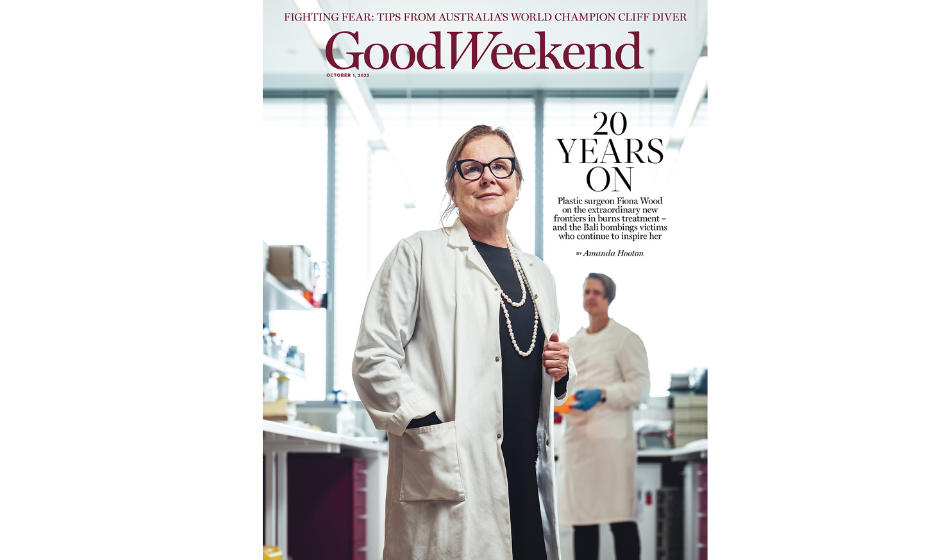 Image for Examples of deep partial thickness burns.