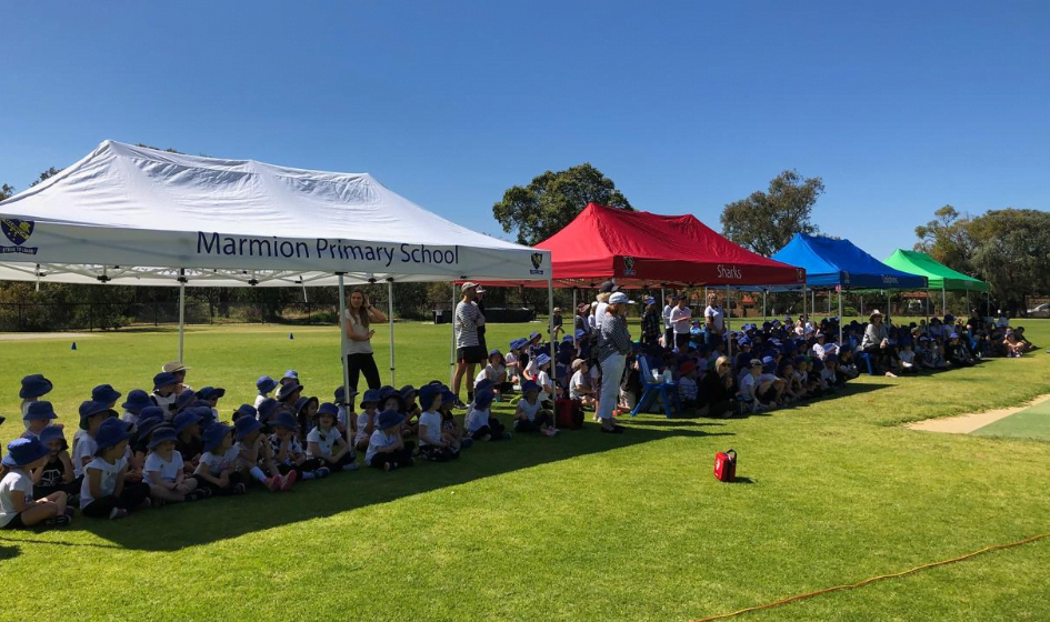 Image for Examples of deep partial thickness burns.