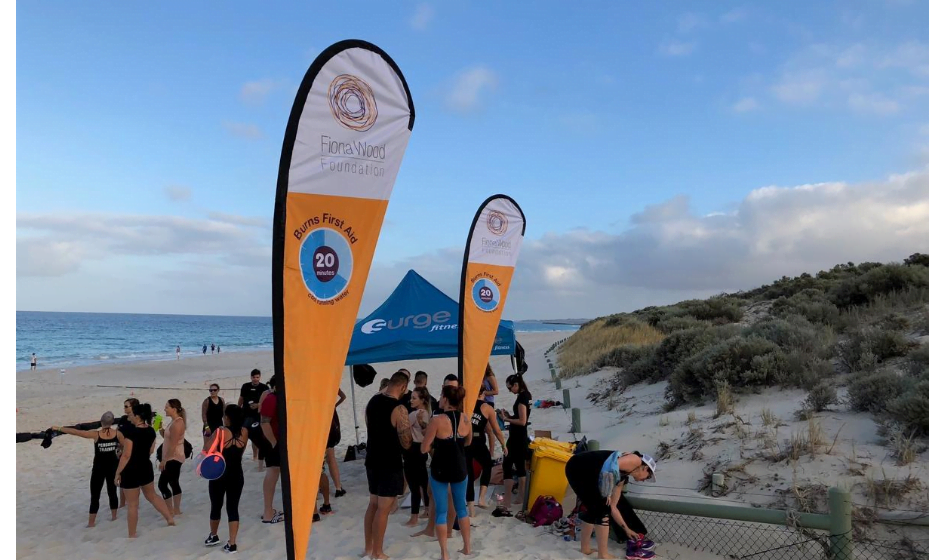 Image for Examples of deep partial thickness burns.